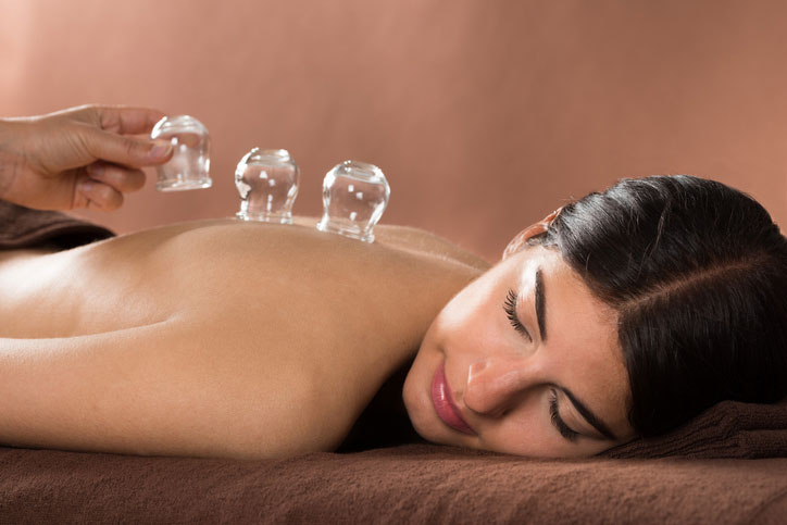 Cupping therapy at Delray Beach Cryo
